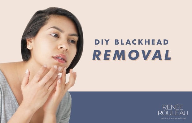 A woman removing a blackhead from her chin