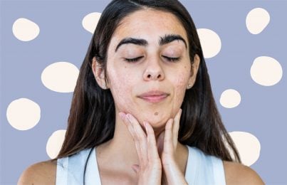 a woman with her hands on her jaw