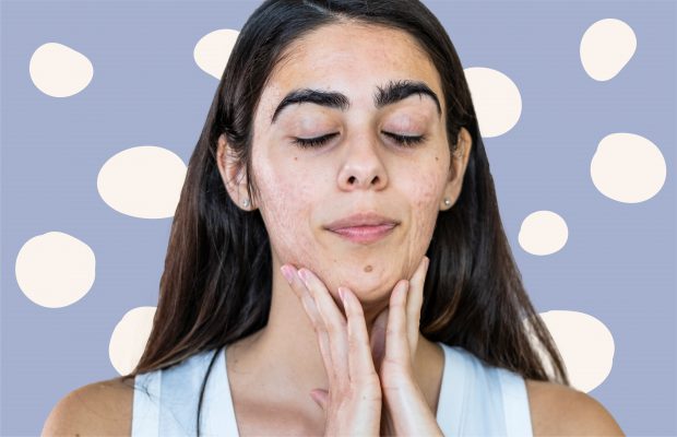 a woman with her hands on her jaw
