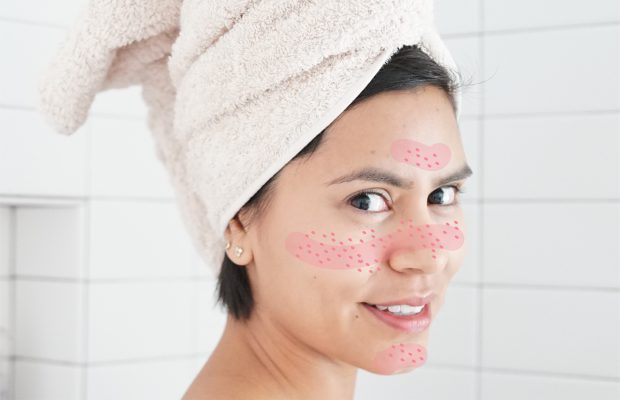 young woman showing facial redness and rosacea
