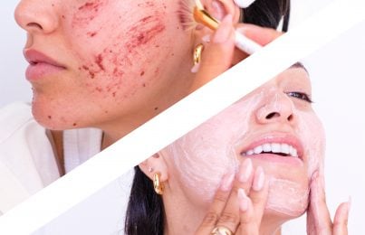 chemical and physical exfoliation to fade dark spots on face
