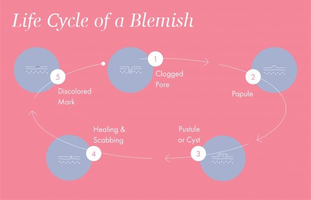 the life cycle of a blemish